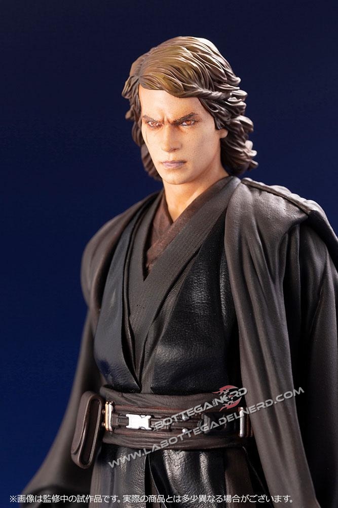 ANAKIN 10