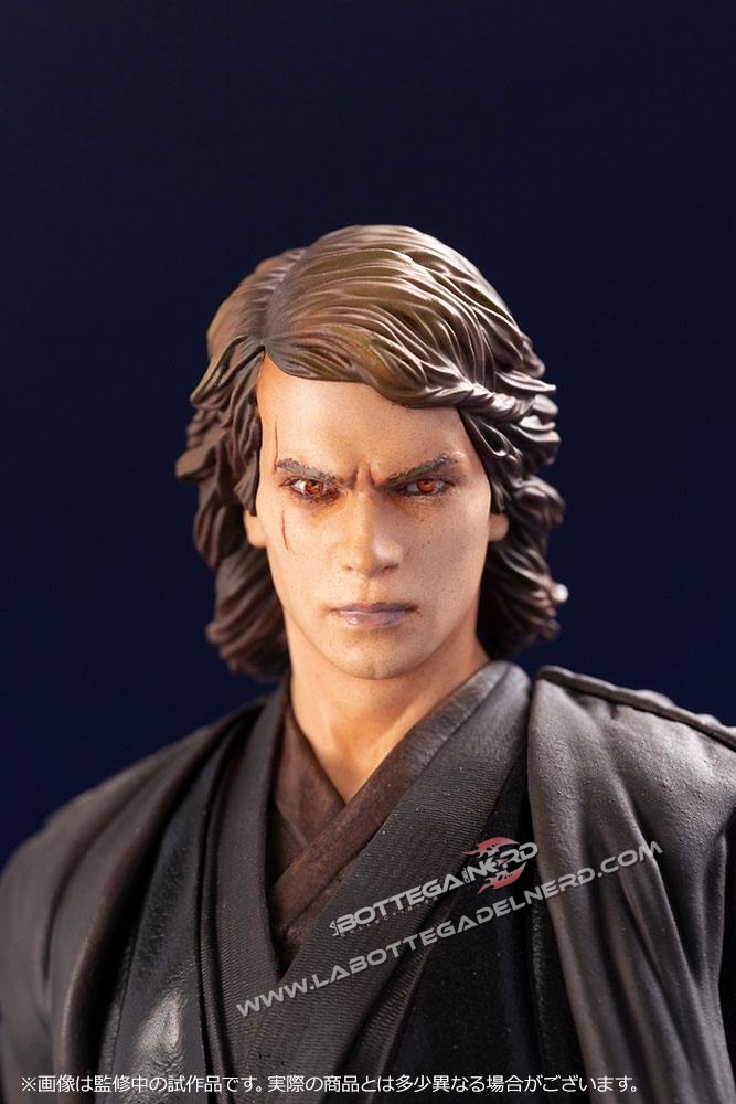 ANAKIN 11